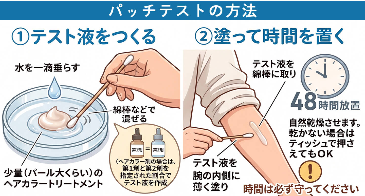 パッチテスト